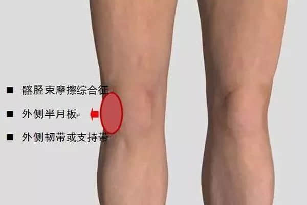 一分钟搞懂你的“膝盖痛”