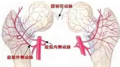 股骨头坏死和肾虚是否有关系？