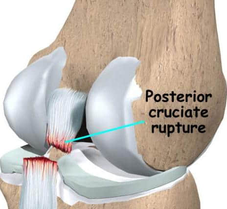 当你的膝盖疼痛时，你该怎么办呢？