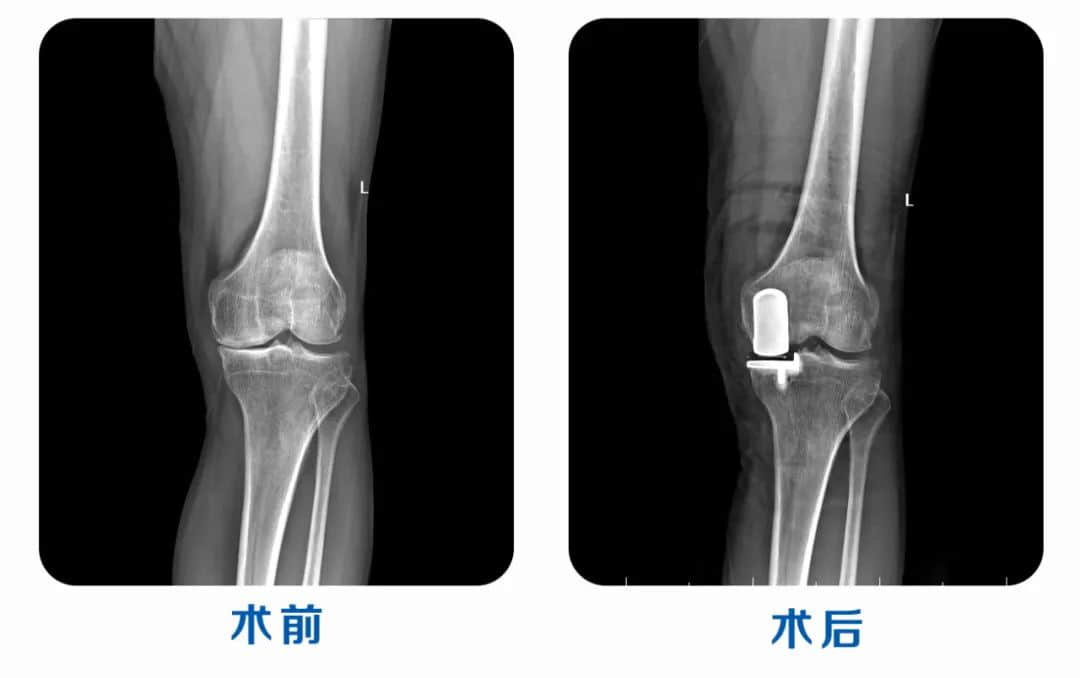 莲池荣耀|热烈祝贺我院业务院长吕岩荣获全国单髁手术技术大赛三等奖