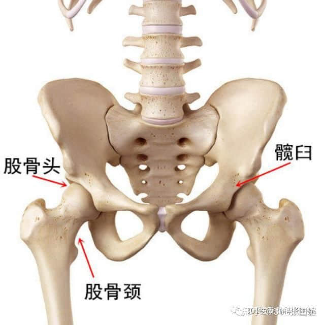 成人先天性髋关节脱位 怎么治？